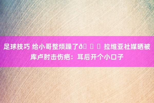 足球技巧 给小哥整烦躁了😅拉维亚社媒晒被库卢肘击伤疤：耳后开个小口子